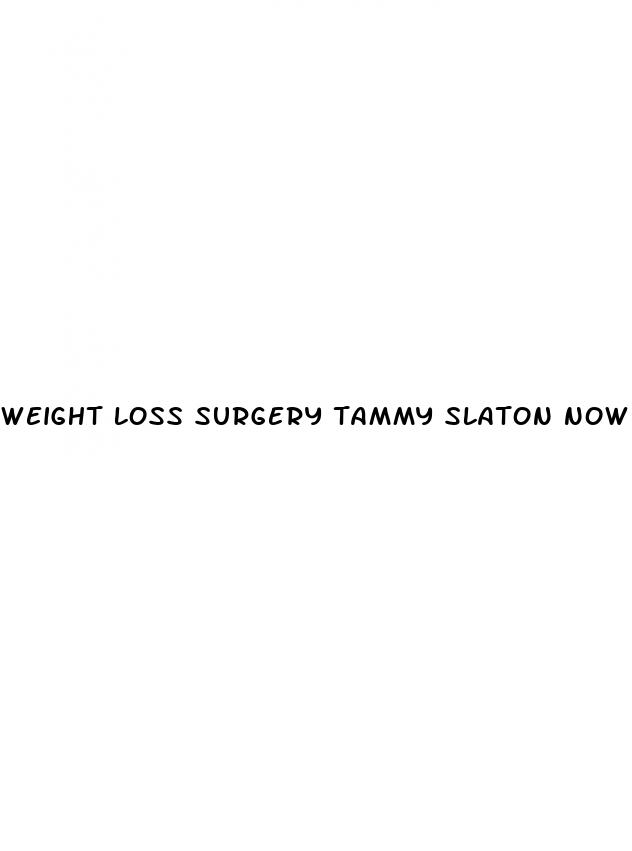 weight loss surgery tammy slaton now