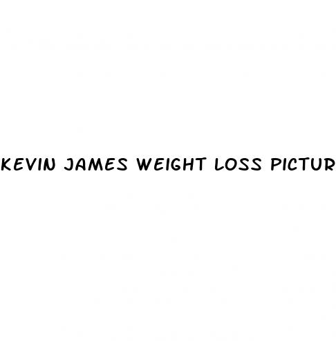 kevin james weight loss pictures