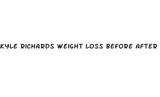 kyle richards weight loss before after