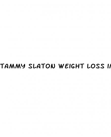 tammy slaton weight loss images