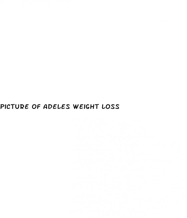 picture of adeles weight loss