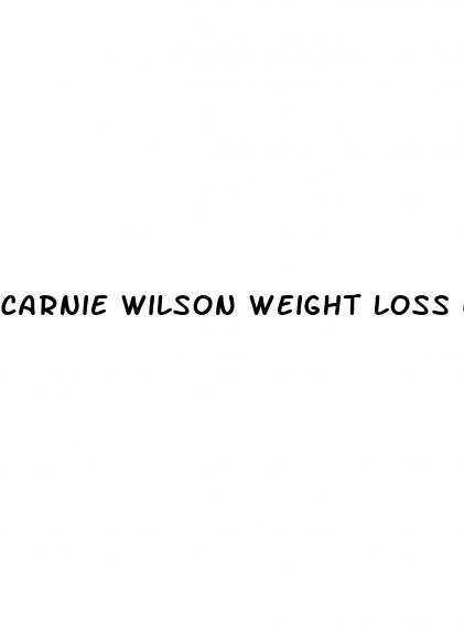 carnie wilson weight loss charity