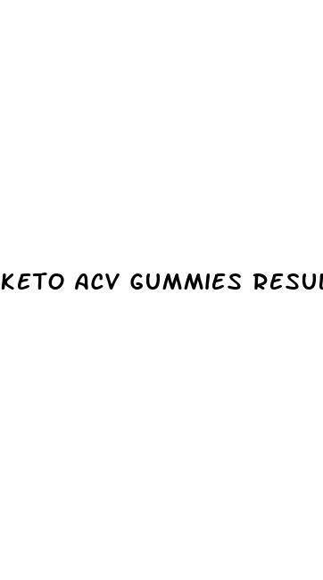 keto acv gummies results