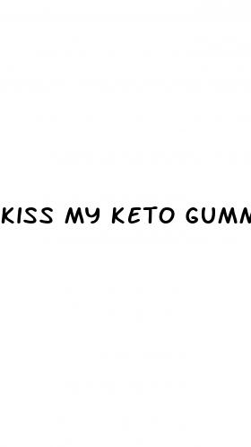 kiss my keto gummies stores