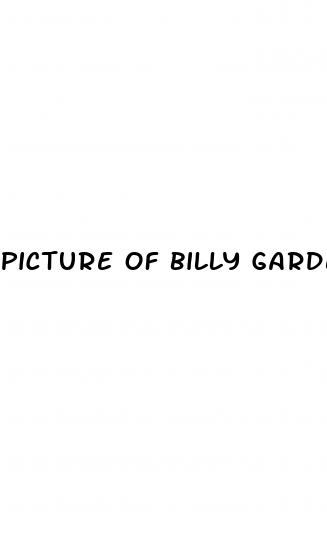 picture of billy gardell after weight loss