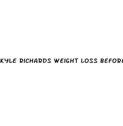 kyle richards weight loss before and after