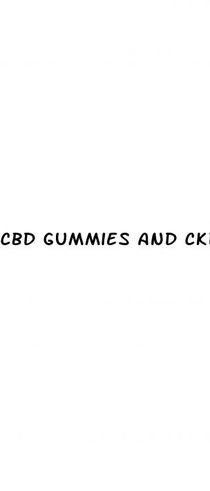 cbd gummies and ckd