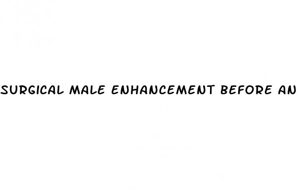 surgical male enhancement before and after