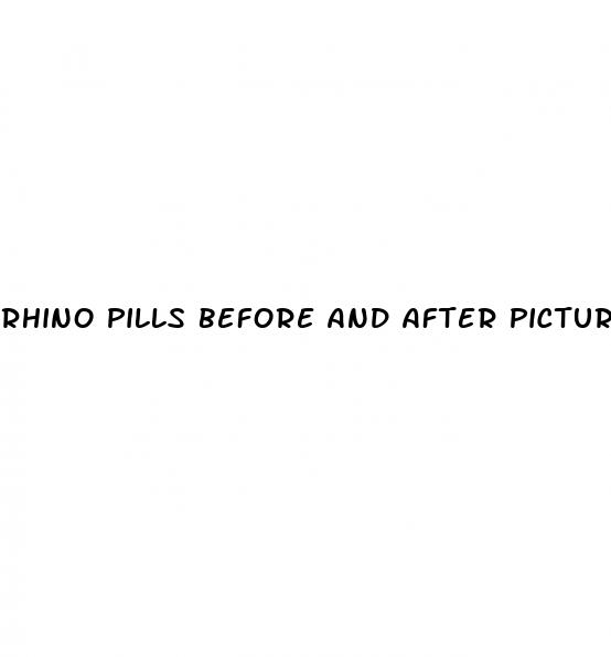 rhino pills before and after pictures