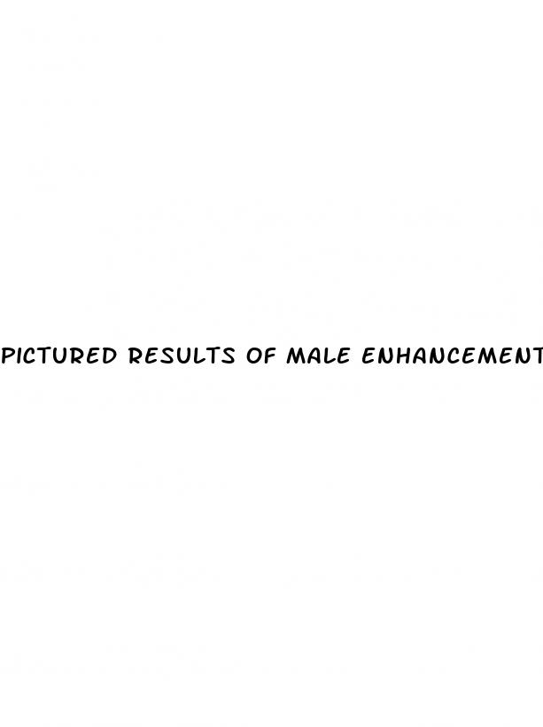 pictured results of male enhancement pills