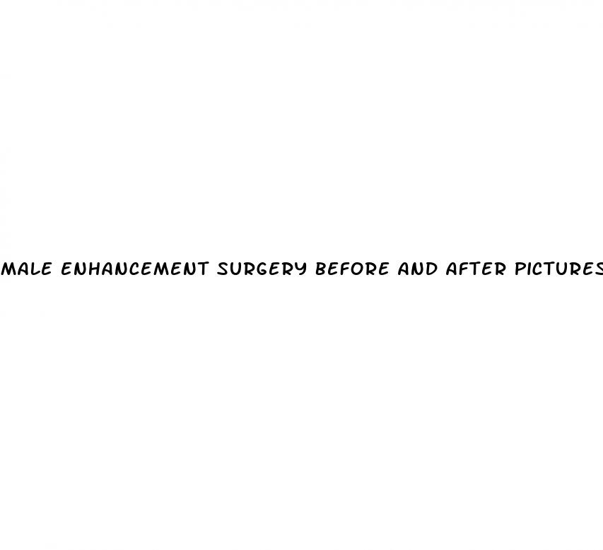 male enhancement surgery before and after pictures