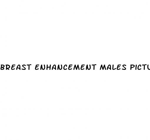 breast enhancement males pictures