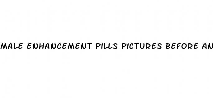 male enhancement pills pictures before and after